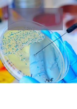 person swabbing a petri dish